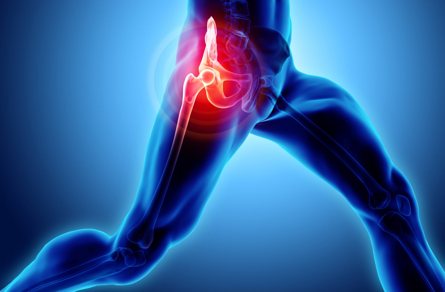 Managing Pain After Hip and Knee Joint Replacement Surgery West